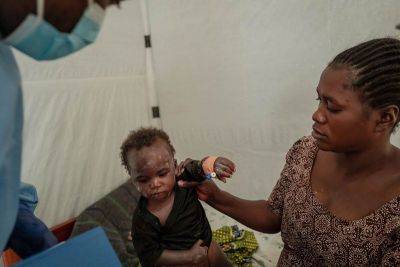 Mpox cases rise in DR Congo as country awaits vaccines - philstar.com - Usa - Sweden - Japan - Kenya - Rwanda - Congo - Uganda - Burundi