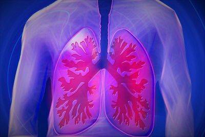 KasamBuhay - Interstitial Lung Disease: Alamin at labanan | Pilipino Star Ngayon - philstar.com - Philippines - county Luna - city Santiago